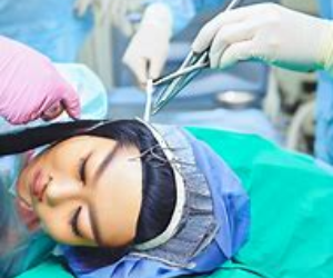 Hair Transplant Surgery: Surgical Procedures to Restore Hair Growth