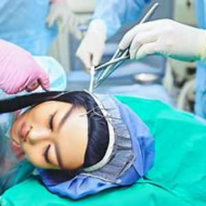 A woman under going hair transplant surgery