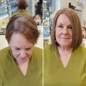 Female Hair Loss Mesh Hair Integration